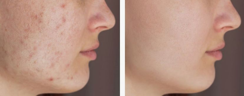 Before & After